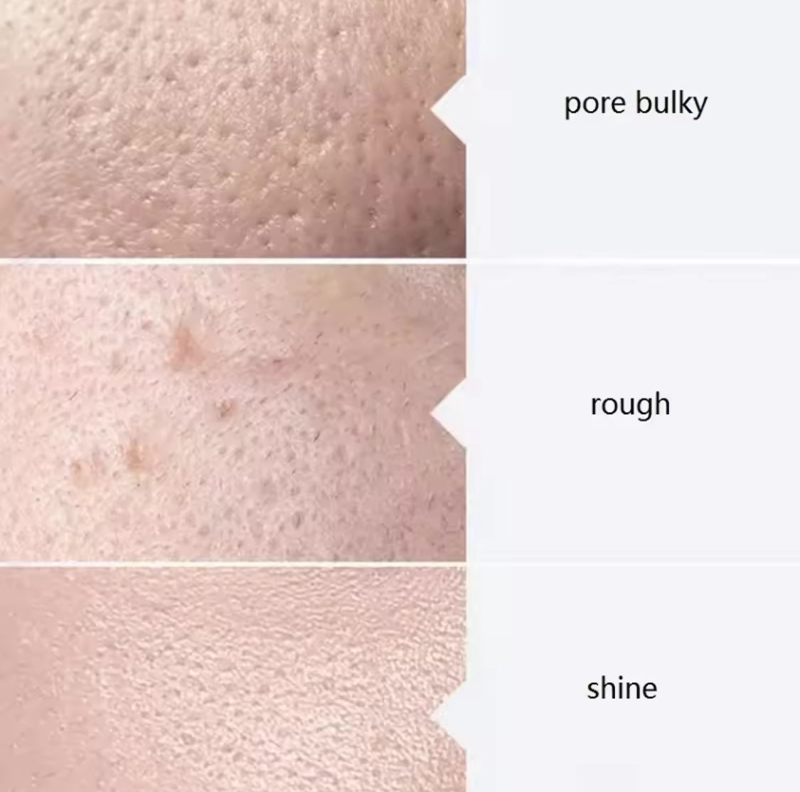 Aqua Peeling Solution — Sérum Facial Dermabrasion & Nettoyage Sébum